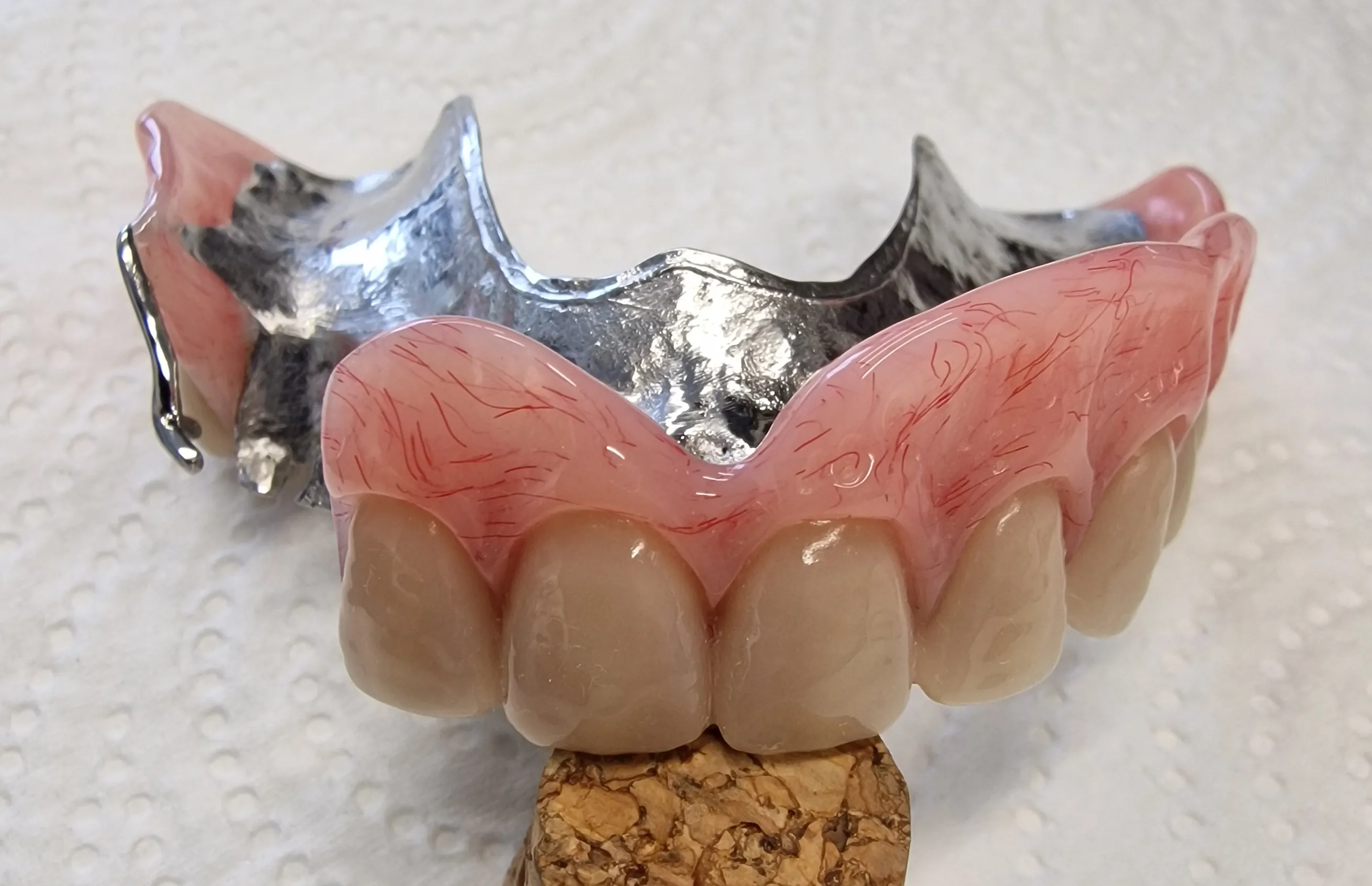 partial denture