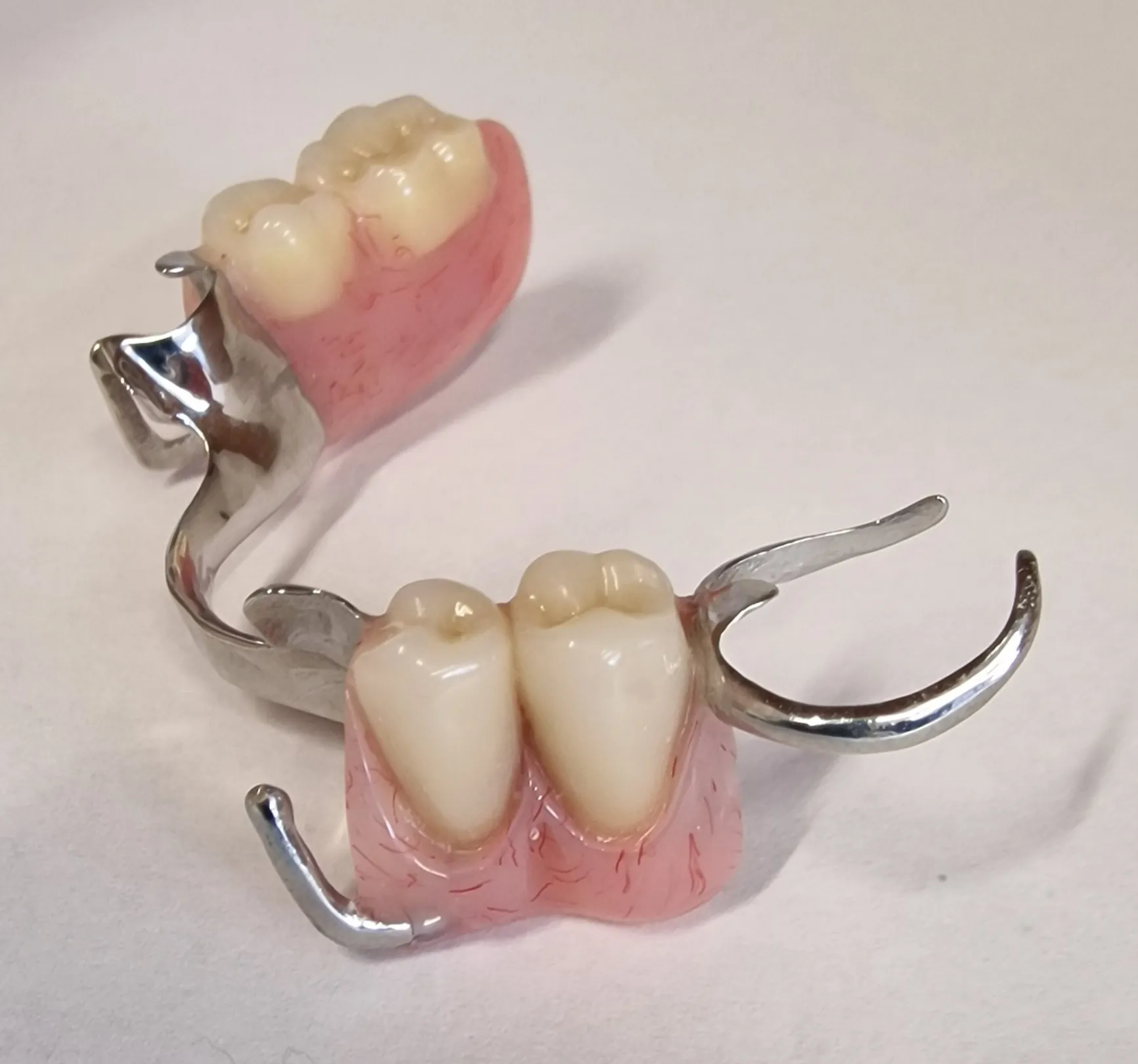 partial denture