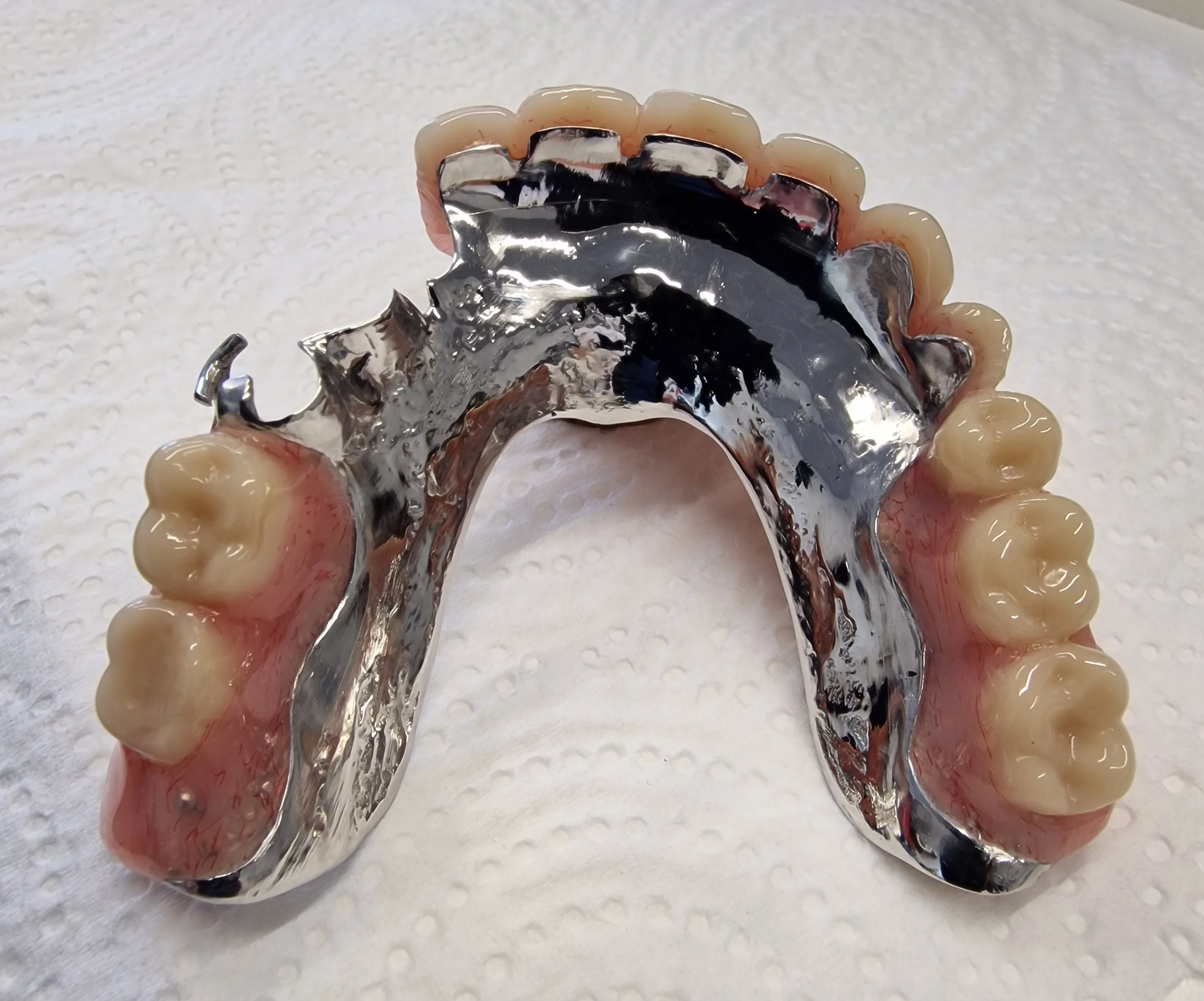 partial denture