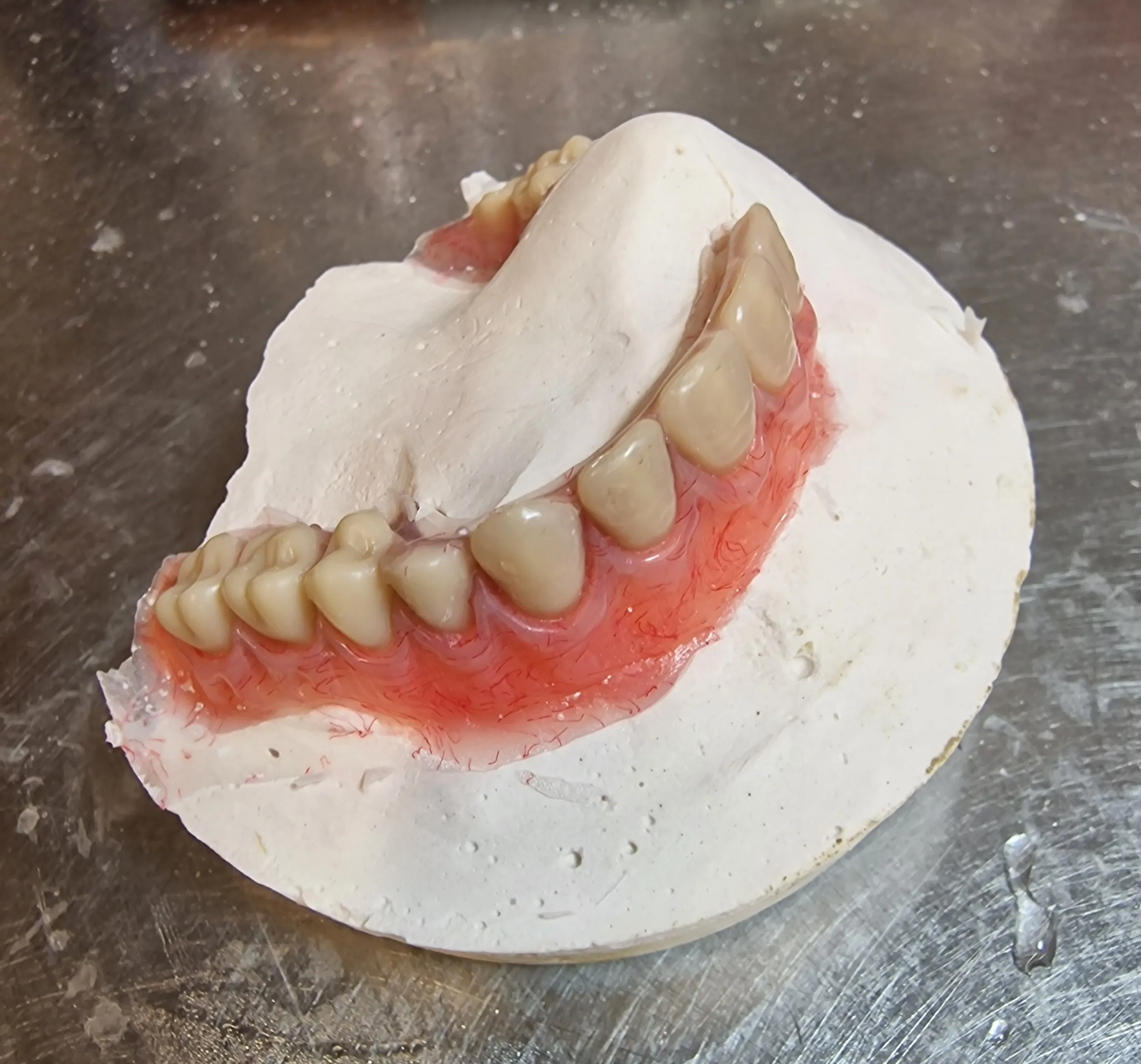 dentures