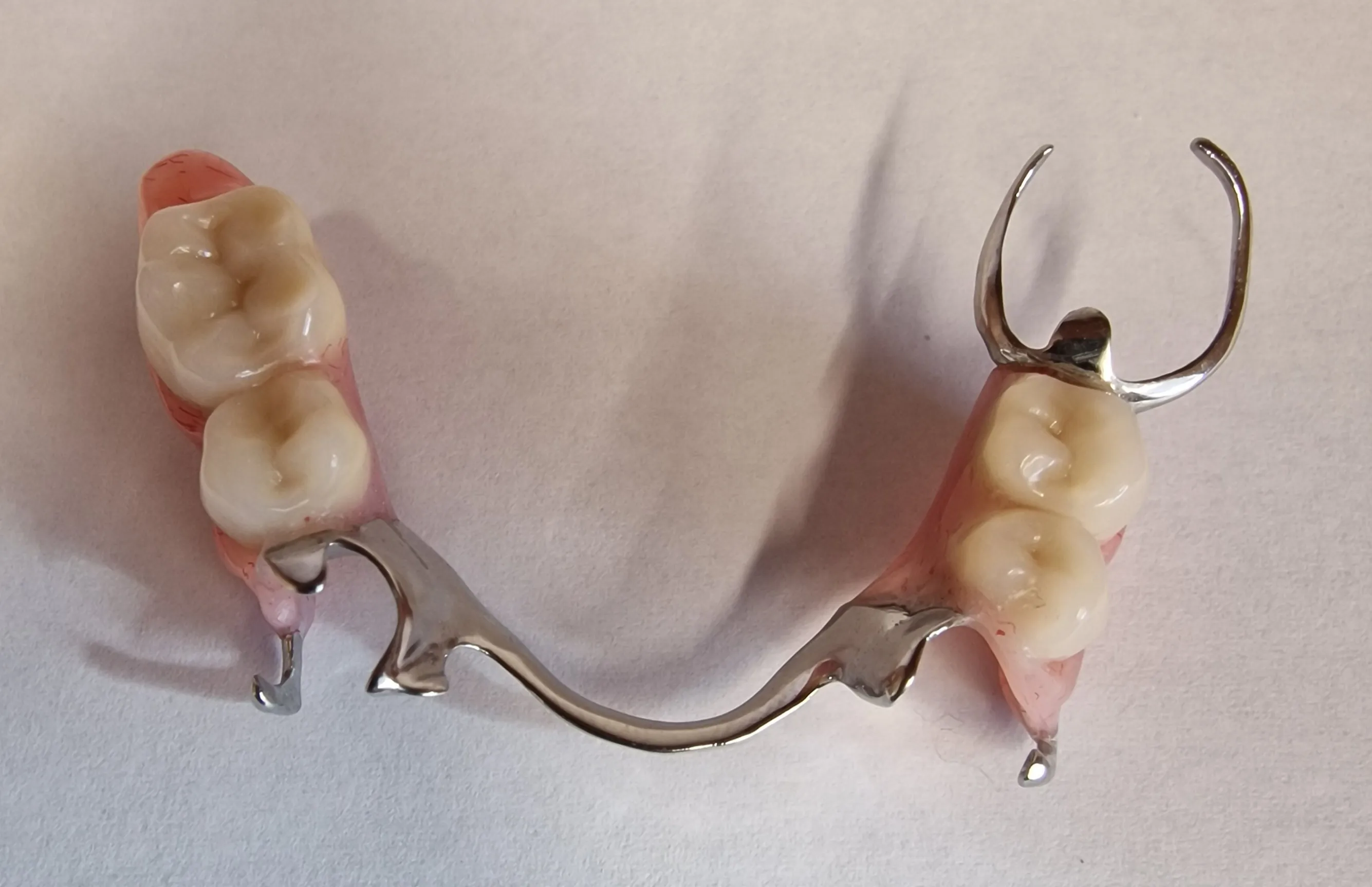 partial denture