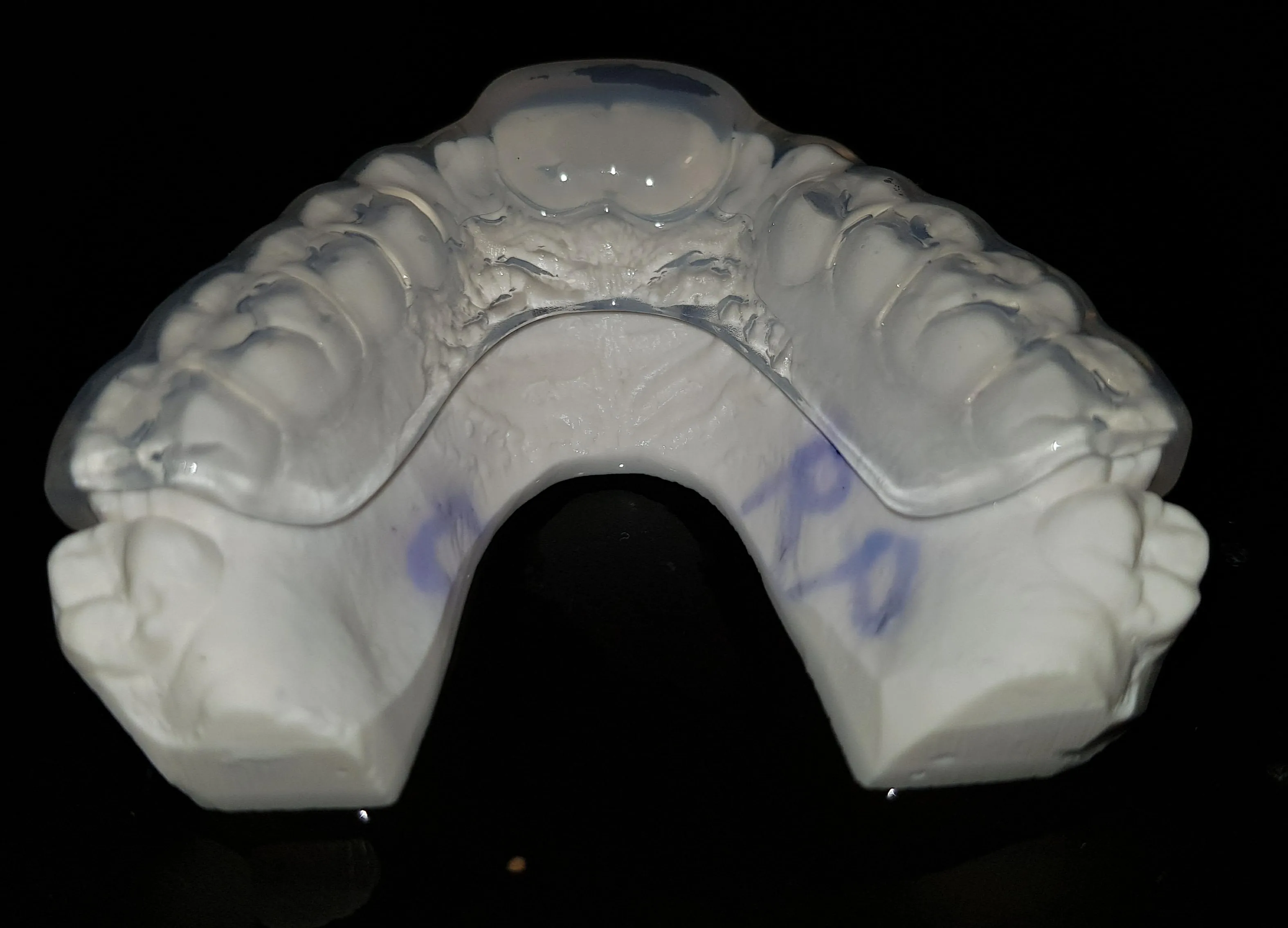 denture mould