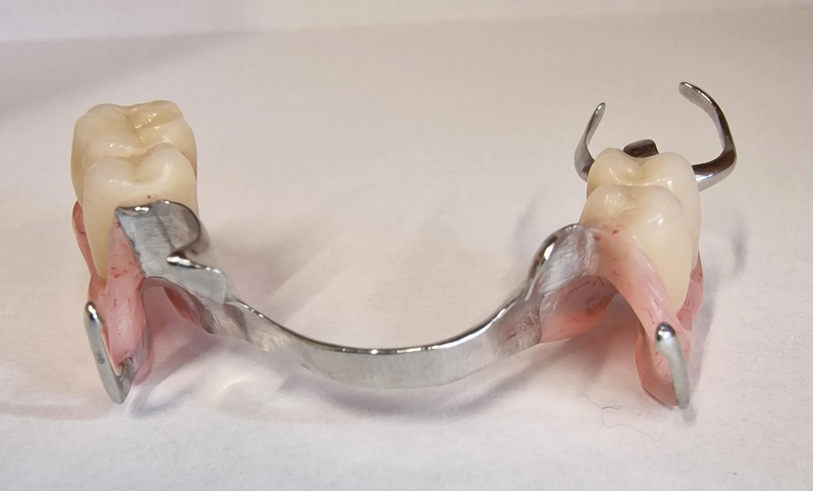 partial denture