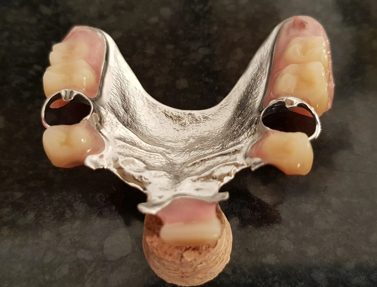 partial denture