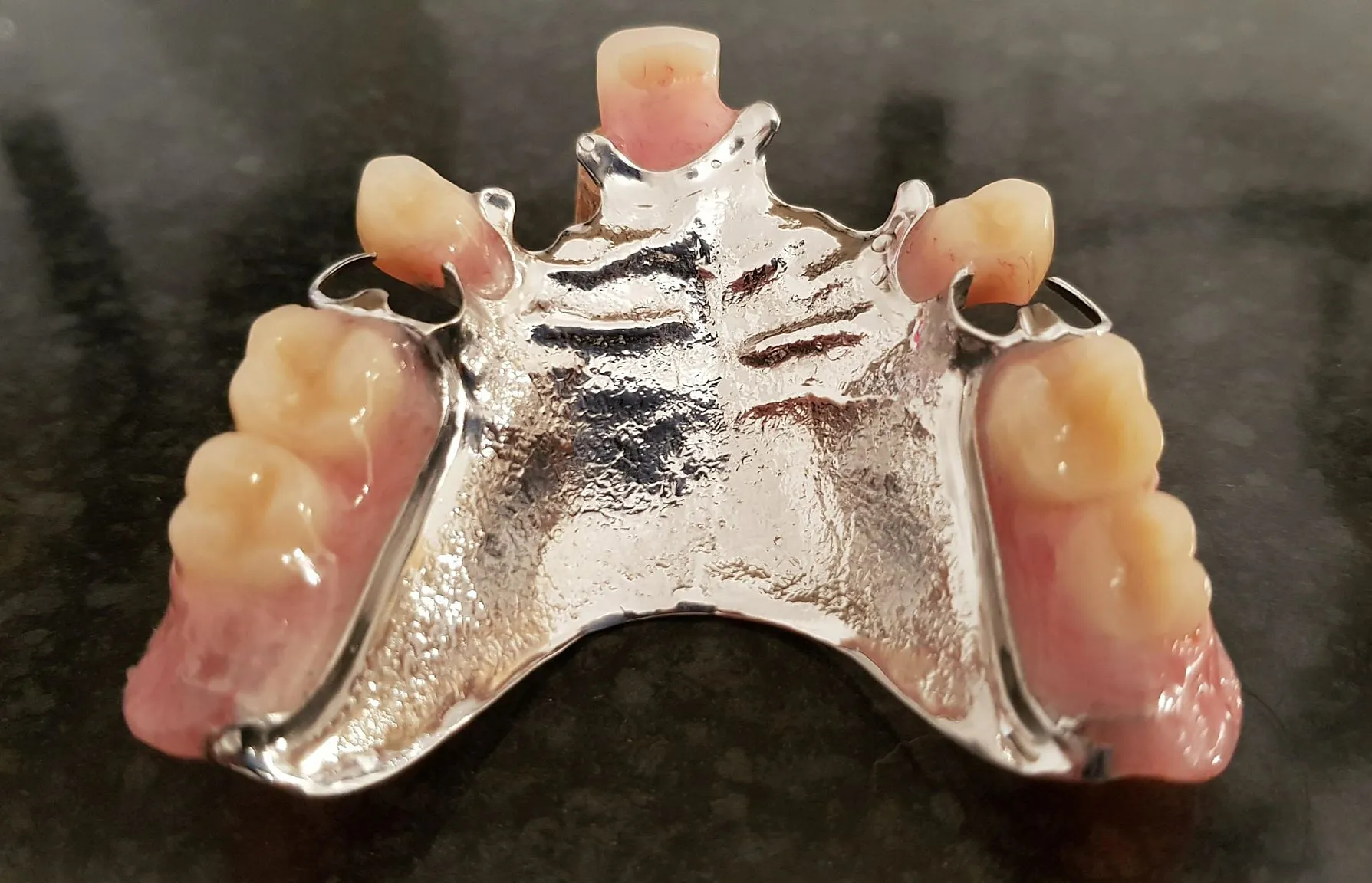 partial denture