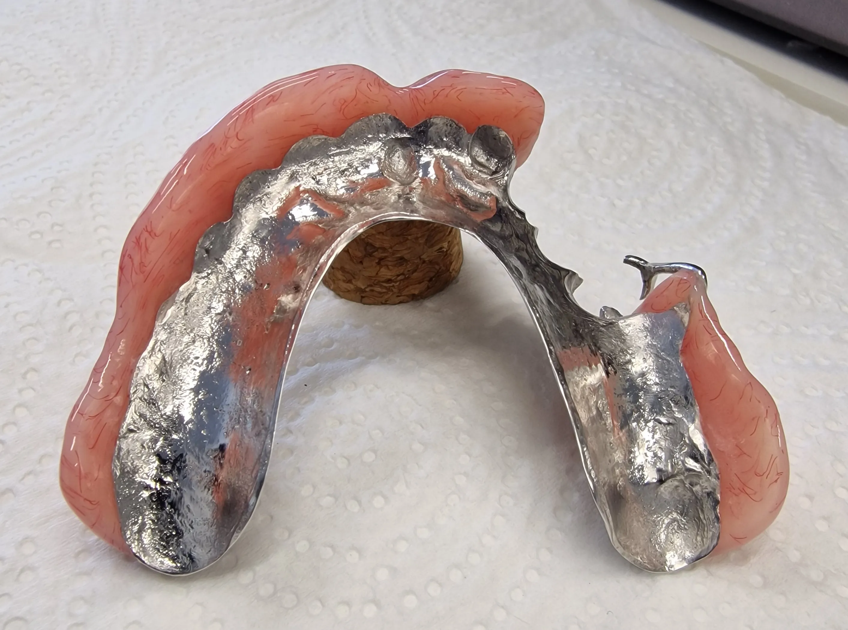 partial denture