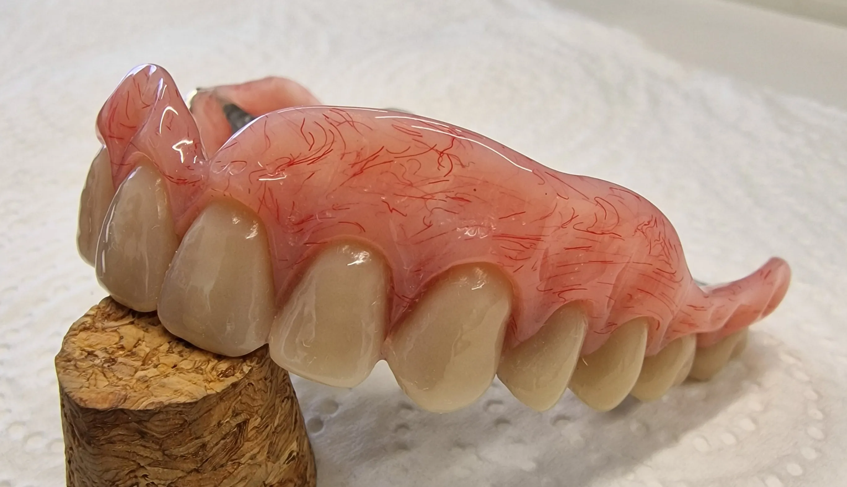 partial denture